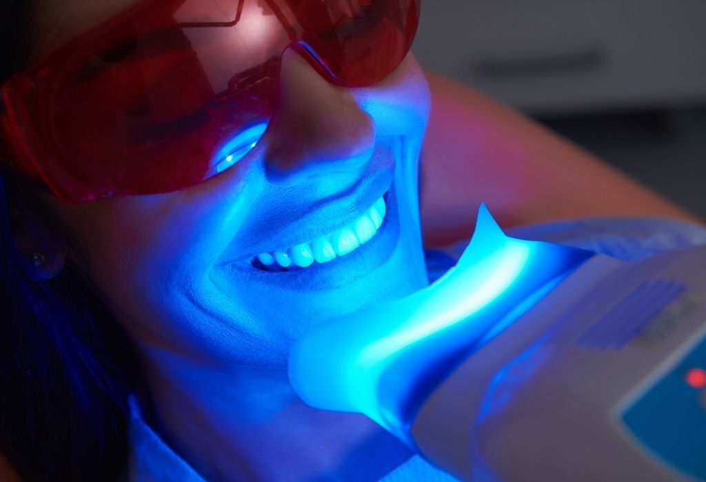 Teeth whitening